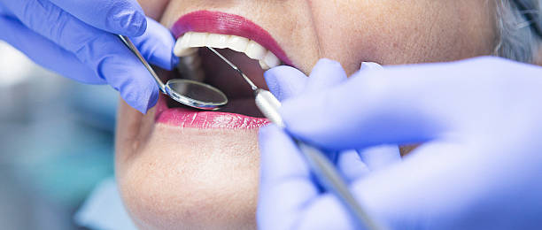 Best Broken or Cracked Tooth Emergency Dentist in Port Labelle, FL